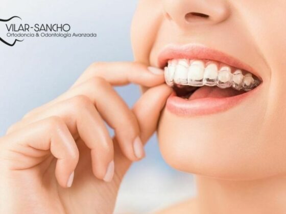Prevención Dental En Pozuelo De Alarcón | Clínica Vilar Sancho