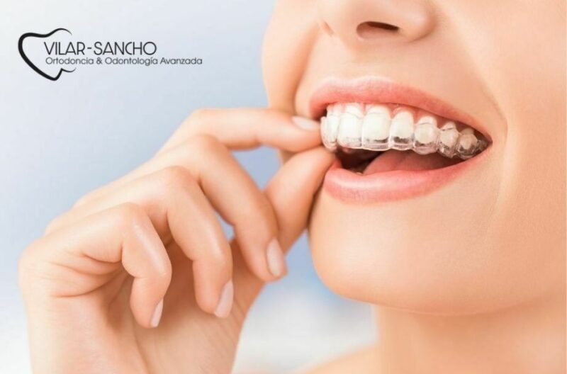 Prevención Dental En Pozuelo De Alarcón | Clínica Vilar Sancho