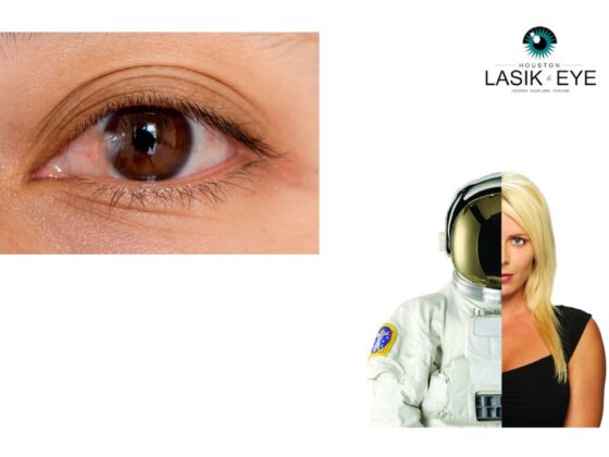 Effective Natural Ways to Ease Pterygium Discomfort