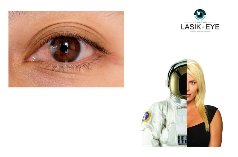 Effective Natural Ways to Ease Pterygium Discomfort