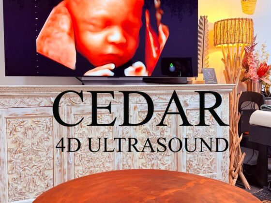 Safe, Family-Friendly 3D/4D Ultrasound Sessions in Perth