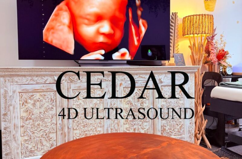 Safe, Family-Friendly 3D/4D Ultrasound Sessions in Perth