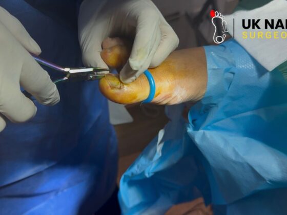 Relief for Toenail Pain: Safe, Effective Care Options