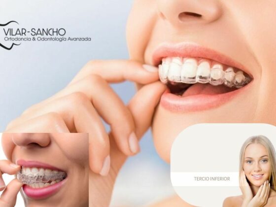 Sonrisa segura con soluciones dentales asequibles en Pozuelo