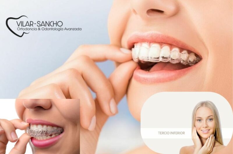 Sonrisa segura con soluciones dentales asequibles en Pozuelo