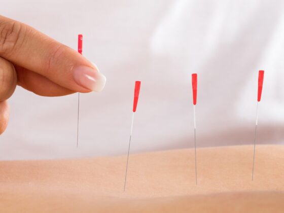 Trusted Physiotherapy Services in Royal Oak Area