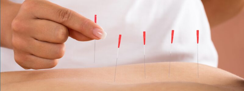 Trusted Physiotherapy Services in Royal Oak Area