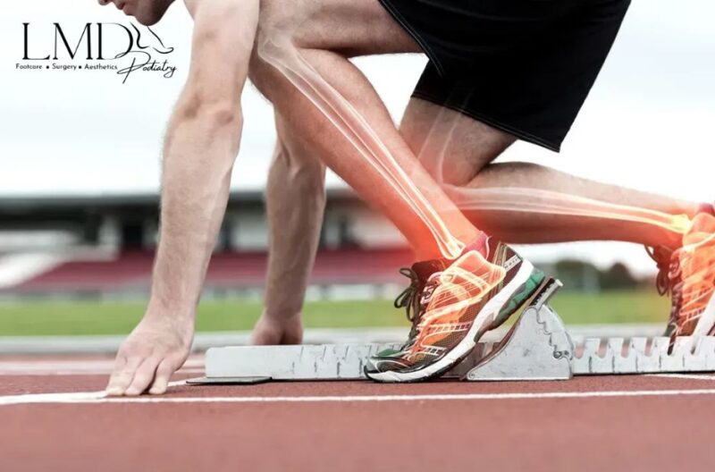 Revolutionary Foot Pain Relief with Advanced Shockwave Therapy in South Florida