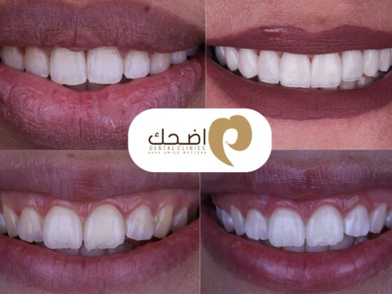 مختصون في ابتسامة صحية وجذابة عبر تقنيات تجميل الأسنان المتطورة