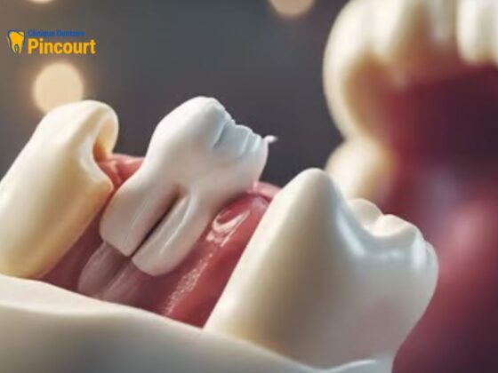 Restore Your Smile at a Trusted Pincourt Denture Clinic