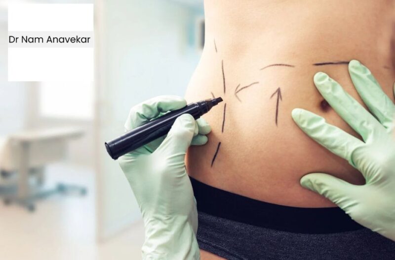 Transform Your Silhouette: Safe, Personalized Body Shaping Solutions