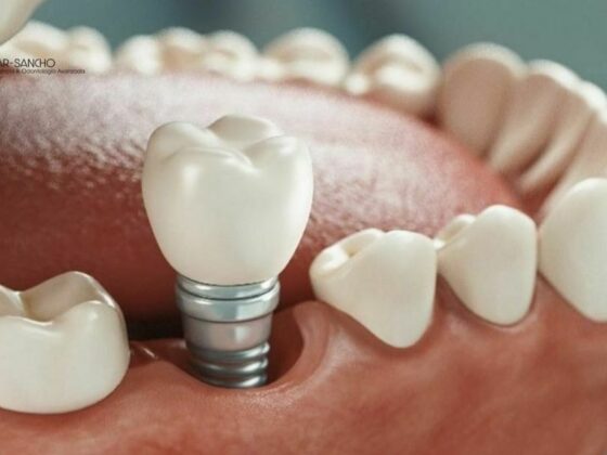 Top Pozuelo Dental Clinic for Your Smile Needs