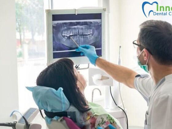 Gentle Wisdom Teeth Extraction in Orleans for a Smooth Recovery