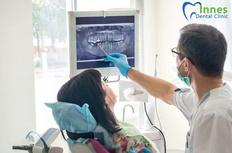 Gentle Wisdom Teeth Extraction in Orleans for a Smooth Recovery