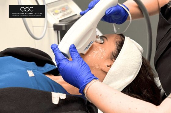 Find Trusted Botox Clinics Nearby for Natural Looking Results