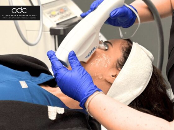 Find Trusted Botox Clinics Nearby for Natural Looking Results