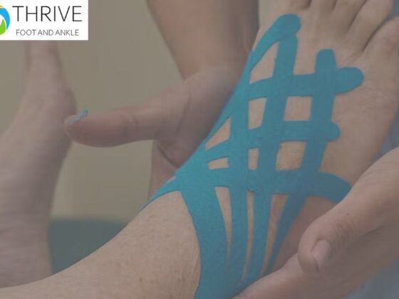 Effective Ankle Wound Treatment for Faster Healing and Restored Mobility