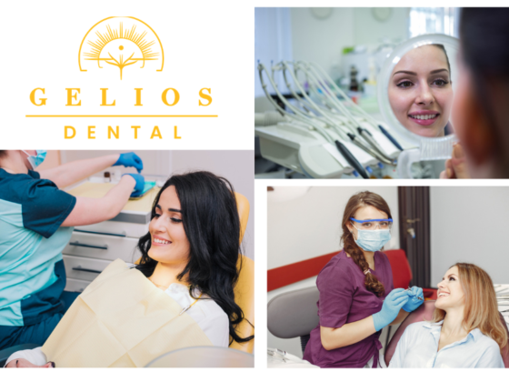 Restore Smiles Using Dental fillings dentist Winnipeg Experts
