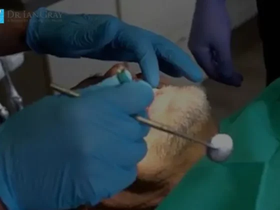 Jaw Development Dentist Newmarket | Expert Jaw Growth Treatment at Dr. Ian Gray Dental Group