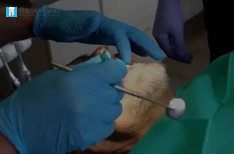 Jaw Development Dentist Newmarket | Expert Jaw Growth Treatment at Dr. Ian Gray Dental Group