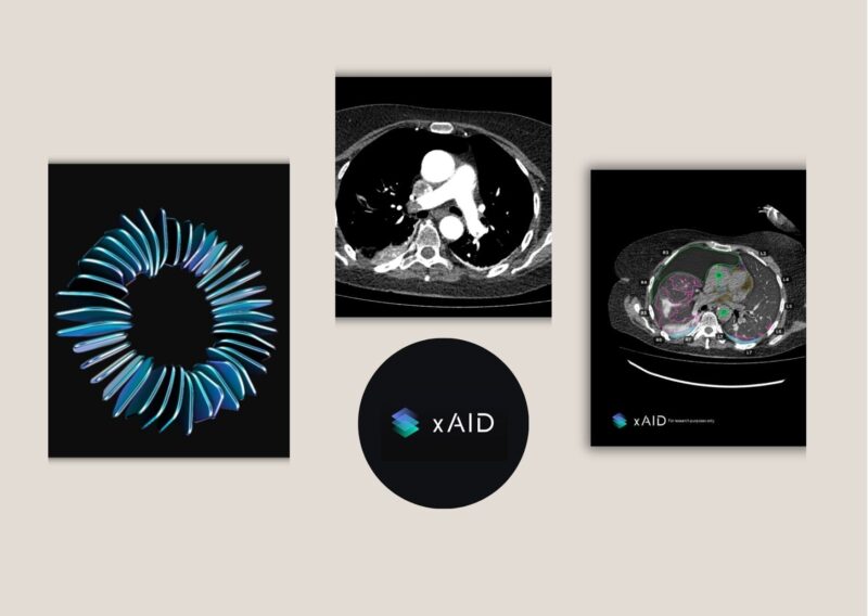 How AI in Radiology Improves Accuracy and Workflow