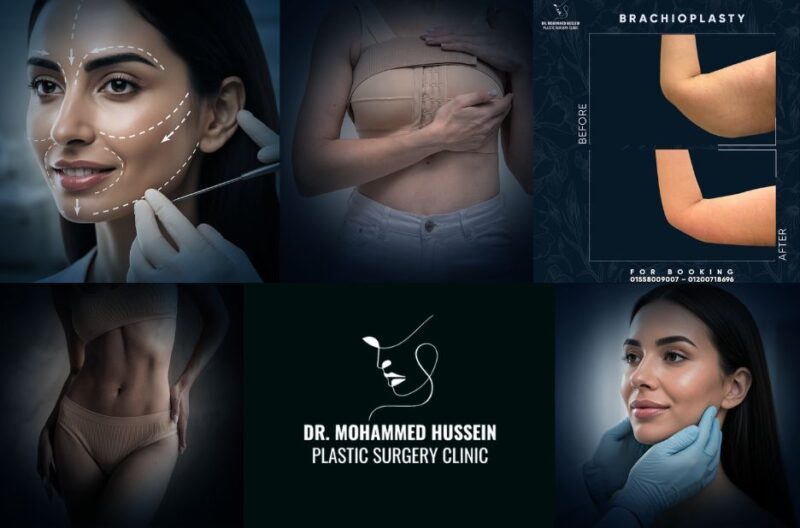 اسعار عمليات التجميل في مصر للسعوديين مع استشارة مختصة